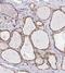 GLIS Family Zinc Finger 3 antibody, NBP2-33787, Novus Biologicals, Immunohistochemistry paraffin image 