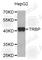 RISC-loading complex subunit TARBP2 antibody, A4138, ABclonal Technology, Western Blot image 