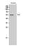 Tyrosine-protein kinase CSK antibody, STJ92497, St John