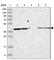 Sterol O-Acyltransferase 2 antibody, HPA025765, Atlas Antibodies, Western Blot image 