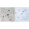 A-Kinase Anchoring Protein 1 antibody, PA5-49861, Invitrogen Antibodies, Immunohistochemistry paraffin image 