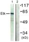 BMX Non-Receptor Tyrosine Kinase antibody, LS-C117749, Lifespan Biosciences, Western Blot image 