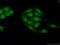 Sirtuin 1 antibody, 60303-1-Ig, Proteintech Group, Immunofluorescence image 