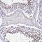 Ubiquitin Conjugating Enzyme E2 L3 antibody, NBP1-92557, Novus Biologicals, Immunohistochemistry frozen image 