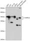 Charged Multivesicular Body Protein 1A antibody, A06756, Boster Biological Technology, Western Blot image 