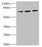 Heat Shock Protein Family A (Hsp70) Member 6 antibody, LS-B13020, Lifespan Biosciences, Western Blot image 