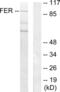 FER Tyrosine Kinase antibody, abx013401, Abbexa, Western Blot image 