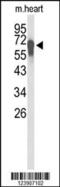 F-Box And Leucine Rich Repeat Protein 5 antibody, 63-931, ProSci, Western Blot image 