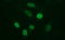 Matrix Metallopeptidase 13 antibody, LS-C788263, Lifespan Biosciences, Immunofluorescence image 