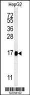 Biogenesis Of Lysosomal Organelles Complex 1 Subunit 2 antibody, MBS9206789, MyBioSource, Western Blot image 