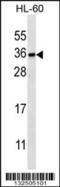 Phosphatidylinositol Transfer Protein Beta antibody, 56-776, ProSci, Western Blot image 