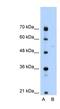 Sep (O-phosphoserine) tRNA:Sec (Selenocysteine) tRNA synthase antibody, NBP1-57253, Novus Biologicals, Western Blot image 