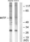 Melanocyte Inducing Transcription Factor antibody, PA5-38294, Invitrogen Antibodies, Western Blot image 