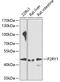 Purinergic Receptor P2Y1 antibody, 23-120, ProSci, Western Blot image 