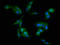 WD Repeat And FYVE Domain Containing 3 antibody, LS-C672676, Lifespan Biosciences, Immunofluorescence image 