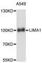 LIM Domain And Actin Binding 1 antibody, A11682, ABclonal Technology, Western Blot image 