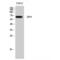 Solute Carrier Family 39 Member 4 antibody, LS-C386712, Lifespan Biosciences, Western Blot image 