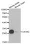 Glutathione S-Transferase Mu 2 antibody, abx001119, Abbexa, Western Blot image 