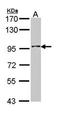 Inositol Polyphosphate-5-Phosphatase B antibody, orb69800, Biorbyt, Western Blot image 