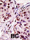Hepatocyte Growth Factor-Regulated Tyrosine Kinase Substrate antibody, 61-121, ProSci, Immunohistochemistry paraffin image 