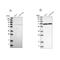 NPL4 Homolog, Ubiquitin Recognition Factor antibody, NBP1-82165, Novus Biologicals, Western Blot image 