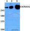 Calcium Voltage-Gated Channel Subunit Alpha1 G antibody, A02645, Boster Biological Technology, Western Blot image 
