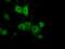 Protein Kinase CAMP-Dependent Type II Regulatory Subunit Alpha antibody, GTX83825, GeneTex, Immunofluorescence image 