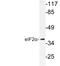 Eukaryotic Translation Initiation Factor 2 Subunit Alpha antibody, LS-C177694, Lifespan Biosciences, Western Blot image 
