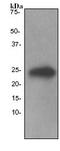 Thymidine Kinase 1 antibody, ab76495, Abcam, Western Blot image 