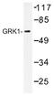 G Protein-Coupled Receptor Kinase 1 antibody, AP01451PU-N, Origene, Western Blot image 