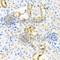 Cystatin S antibody, A8114, ABclonal Technology, Immunohistochemistry paraffin image 