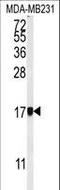 Adaptor Related Protein Complex 1 Subunit Sigma 1 antibody, LS-C156383, Lifespan Biosciences, Western Blot image 