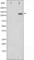Integrin Subunit Beta 3 antibody, abx011022, Abbexa, Western Blot image 