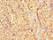 Lysosomal protective protein antibody, LS-C396275, Lifespan Biosciences, Immunohistochemistry paraffin image 