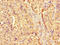 Cathepsin A antibody, LS-C396275, Lifespan Biosciences, Immunohistochemistry paraffin image 