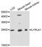 Lysophospholipase 1 antibody, A4419, ABclonal Technology, Western Blot image 