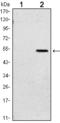 SUZ12 Polycomb Repressive Complex 2 Subunit antibody, M00583-1, Boster Biological Technology, Western Blot image 