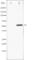 Activating Transcription Factor 2 antibody, abx012098, Abbexa, Western Blot image 