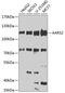 Alanyl-TRNA Synthetase 2, Mitochondrial antibody, 23-211, ProSci, Western Blot image 