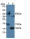Interferon Gamma antibody, LS-C294754, Lifespan Biosciences, Western Blot image 