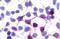 G Protein-Coupled Receptor 45 antibody, GTX12574, GeneTex, Immunocytochemistry image 
