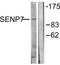 SUMO Specific Peptidase 7 antibody, TA315656, Origene, Western Blot image 