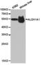 Aldehyde Dehydrogenase 1 Family Member A1 antibody, LS-C192692, Lifespan Biosciences, Western Blot image 