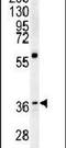 Microtubule Associated Protein RP/EB Family Member 1 antibody, PA5-25913, Invitrogen Antibodies, Western Blot image 