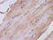 TNFAIP3 Interacting Protein 1 antibody, LS-C670285, Lifespan Biosciences, Immunohistochemistry paraffin image 