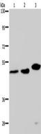 Tyrosyl-DNA Phosphodiesterase 2 antibody, TA351171, Origene, Western Blot image 