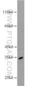 Enolase-Phosphatase 1 antibody, 17731-1-AP, Proteintech Group, Western Blot image 