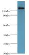 Pesticidal crystal protein Cry1Ac antibody, A54664-100, Epigentek, Western Blot image 