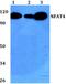Nuclear Factor Of Activated T Cells 3 antibody, PA5-36101, Invitrogen Antibodies, Western Blot image 