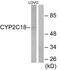 Cytochrome P450 Family 2 Subfamily C Member 18 antibody, TA313723, Origene, Western Blot image 